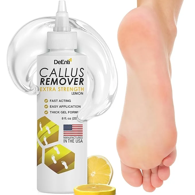 Sophisticated DeEnti Callus Remover for Feet Extra Strength Foot Callus Remover Gel Versatile